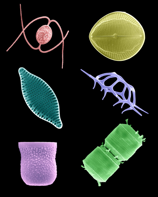 Colorized Plankton #2