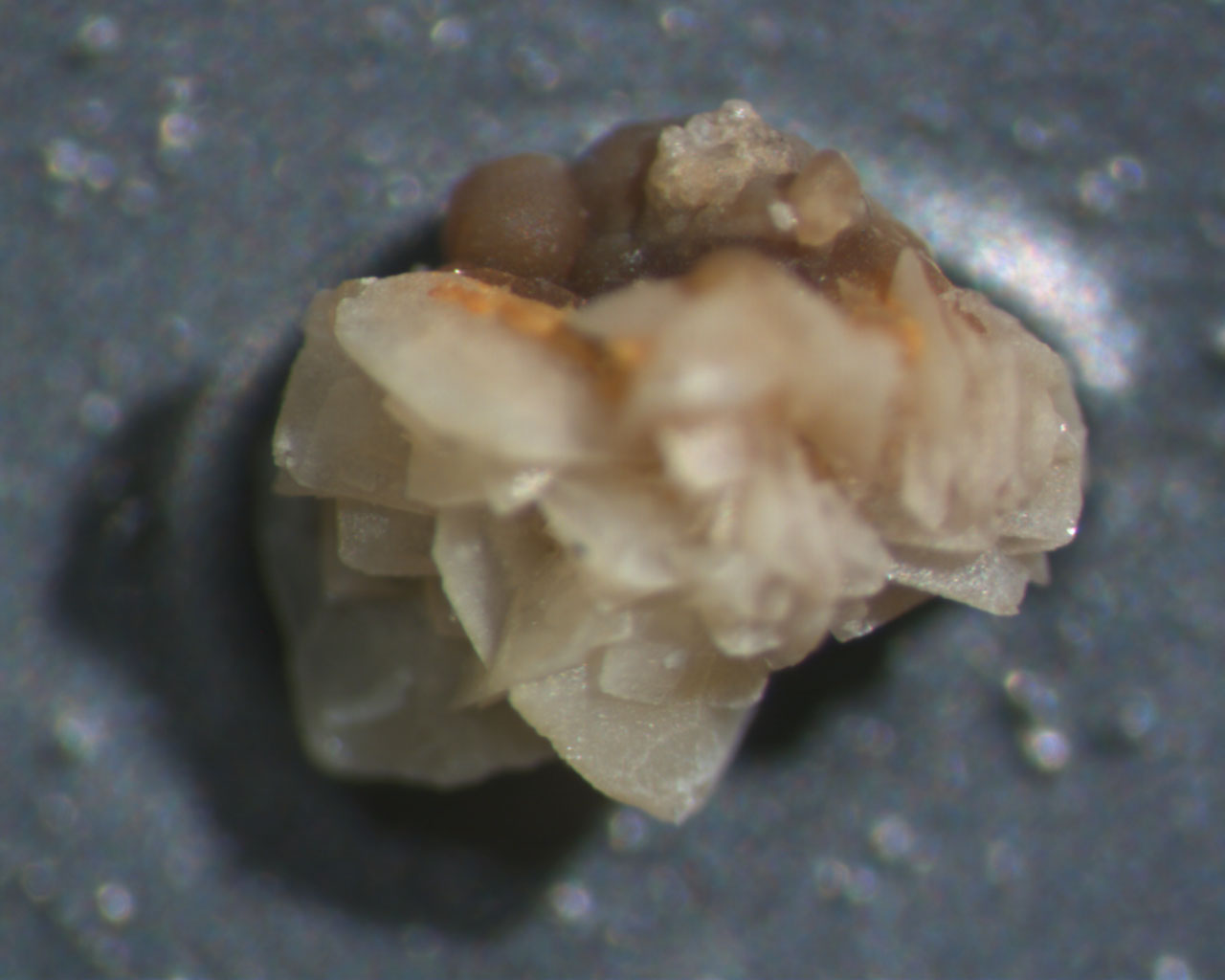 LM kidney stone